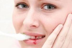 Hết lo chảy máu chân răng với 6 công thức cực đơn giản