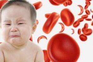 Thiếu máu dinh dưỡng ở trẻ em và cách phòng ngừa bệnh