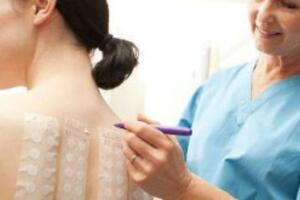 Viêm da tiếp xúc dị ứng – Kiểm tra dị ứng áp da hay test áp