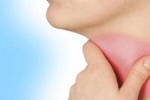 Bài thuốc chữa viêm họng chỉ trong vòng 15 phút