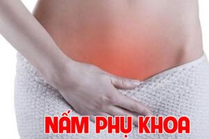 Những điều chị em nhất định phải biết về bệnh viêm nhiễm nấm phụ khoa