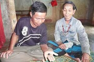 Cứu người bị rắn cắn bằng "ngọc rắn"