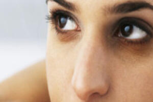 Điểm danh 6 nguyên nhân gây nên thâm quầng mắt