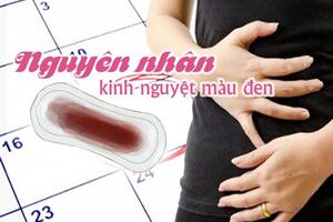Nguyên nhân khiến kinh nguyệt màu đen là gì?