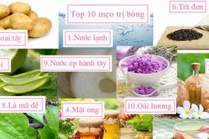 Top 10 mẹo trị bỏng đơn giản mà hiệu quả bất ngờ
