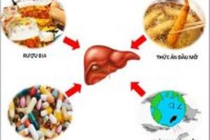 Giải pháp giúp bạn giải quyết những căn bệnh sau dịp tết