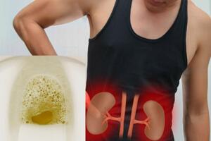 Nước tiểu có bọt, cảnh báo những bệnh nguy hiểm bạn phải biết