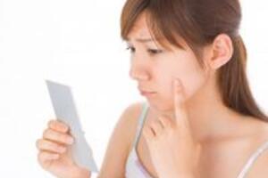 3 Phương pháp ngăn ngừa mụn hiệu quả mà bạn nên biết