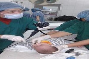 Khi nào cần nội soi dạ dày tá tràng ở trẻ em