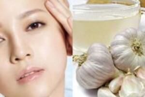 4 mẹo trị mụn bằng tỏi hiệu quả bất ngờ