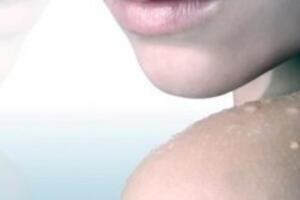 Bệnh về da liên quan đến nghề nghiệp