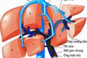 Bệnh viêm gan siêu vi B lây truyền như t...