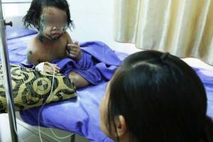 Mẹ chểnh mảng không vệ sinh cẩn thận, con gái 5 tuổi bong tróc da toàn thân