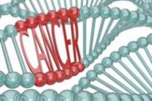 Dấu hiệu phổ biến về bệnh ung thư mà ai cũng cần nên biết