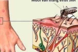 9 thực phẩm bổ dưỡng dễ tìm cho người mắc sốt xuất huyết