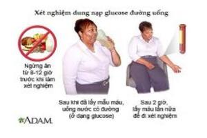 Xét nghiệm dung nạp glucose đường uống
