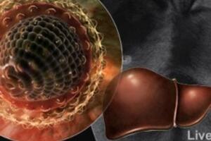 Điều trị viêm gan B