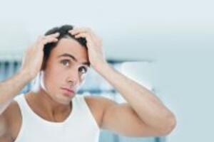 7 Phương pháp giúp các chàng trai tránh tình trạng hói đầu tự nhiên hiệu qua