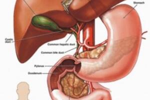 Viêm gan B làm tăng nguy cơ dẫn đến xơ g...