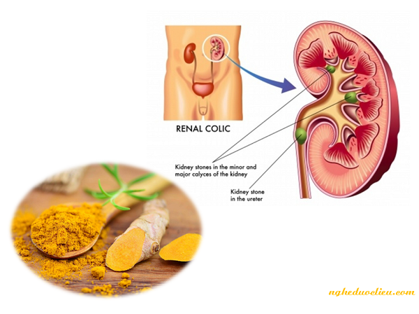 Kết quả nghiên cứu khiến người bệnh dạ dày yên tâm hơn rất nhiều