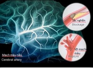 nam-lim-xanh-ngan-tai-bien-mach-mau