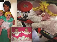 Hội chứng truyền máu thai nhi và ca phẫu thuật thành công kỳ lạ