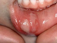 Chồng đi đổi gió  về lây bệnh lậu cho con 2 tuổi, vợ đòi tự tử