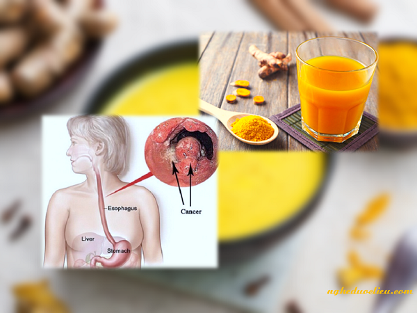 Chữa đau dạ dày hiệu quả bằng tinh bột nghệ nguyên chất