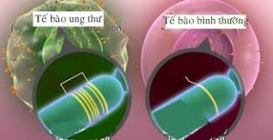 dieu-tri-ung-thu-vu