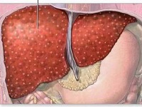 Bỗng dưng mắc bệnh tế nhị, bạn gái nằng nặc đòi chia tay
