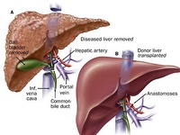 Cách giải độc gan không cần đến thuốc
