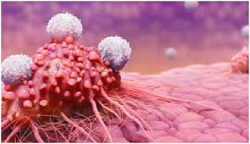 Mất ngủ là nguyên nhân dẫn đến căn bệnh ung thư