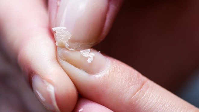 Có những dấu hiệu này chứng tỏ bạn đang bị thiếu canxi một cách trầm trọng - Ảnh 1. Có những dấu hiệu này chứng tỏ bạn đang bị thiếu canxi một cách trầm trọng - Ảnh 1.