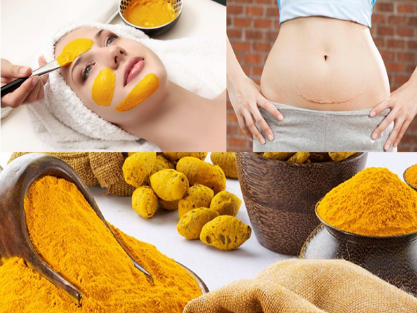 Lý do vì sao tinh bột nghệ có thể giúp bạn giảm cân?