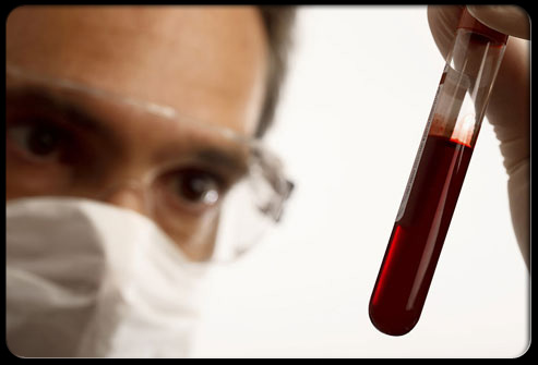 xet-nghiem-chan-doan