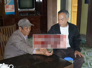 Lương y chữa là khỏi cứu hàng ngàn người khỏi chứng bệnh gan