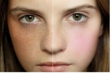 cach-chua-nam-hieu-qua-bang-bai-thuoc-thao-duoc-2