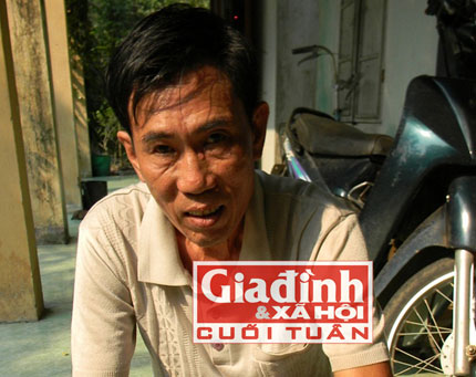 Cuộc đấu tranh bền bỉ của nhà giáo nghèo với bệnh ung thư gan nhờ bài thuốc nam đặc trị 1 Hy hữu: Thoát ung thư gan kỳ diệu nhờ bài thuốc Nam tự chế 1