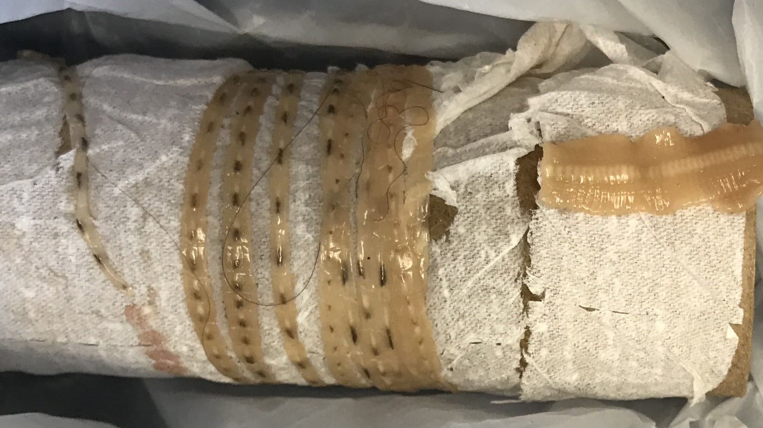 Bác sĩ đứng tim khi chứng kiến con sán dài 2 mét lôi ra từ cơ thể quý ông thích ăn sushi - Ảnh 1. Bác sĩ đứng tim khi chứng kiến con sán dài 2 mét lôi ra từ cơ thể quý ông thích ăn sushi - Ảnh 1.