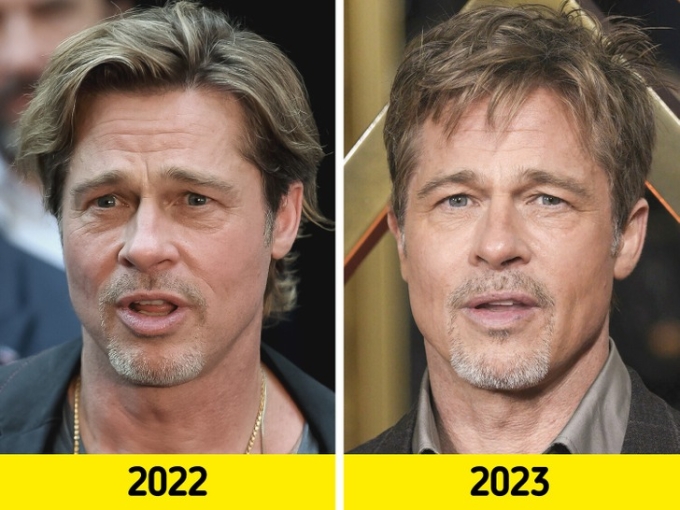 Theo thời gian, làn da của Brad Pitt có sự cải thiện tích cực, săn chắc và ít hằn rõ nếp nhăn hơn. Sự thay đổi ở vùng hàm, cằm cũng khiến tài tử bị nghi vấn nhờ cậy dao kéo.