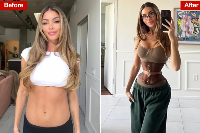 Enna Schell trước và sau khi phẫu thuật tái cấu trúc xương sườn, tạo eo con kiến. Ảnh: Enna Schell